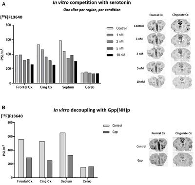 [18F]F13640, a 5-HT1A Receptor Radiopharmaceutical Sensitive to Brain Serotonin Fluctuations